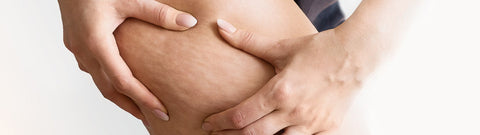 Najskuteczniejsze olejki eteryczne na cellulit - działanie i przykłady zastosowań